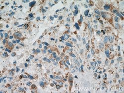 PITRM1 Rabbit anti-Human, Mouse, Rat, Polyclonal, Proteintech 150 &mu;L;