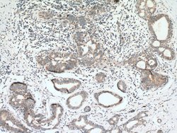 PITRM1 Rabbit anti-Human, Mouse, Rat, Polyclonal, Proteintech 150 &mu;L;