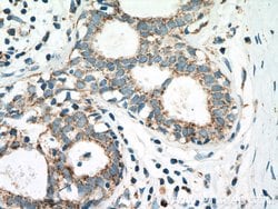 PITRM1 Rabbit anti-Human, Mouse, Rat, Polyclonal, Proteintech 150 &mu;L;