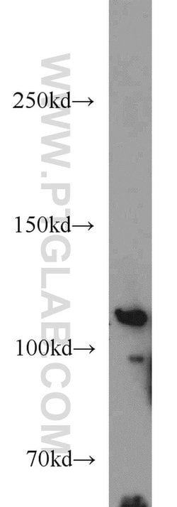 PITRM1 Rabbit anti-Human, Mouse, Rat, Polyclonal, Proteintech 150 &mu;L;