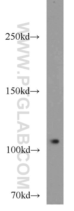 PITRM1 Rabbit anti-Human, Mouse, Rat, Polyclonal, Proteintech 150 &mu;L;