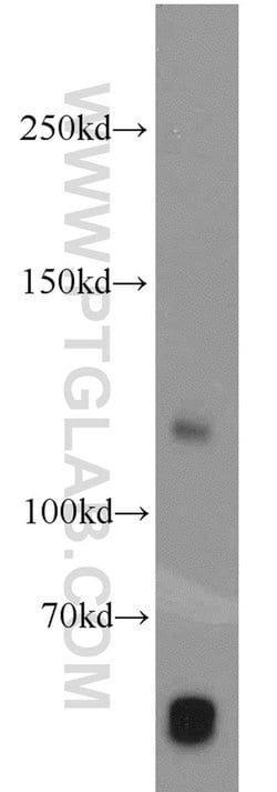 PITRM1 Rabbit anti-Human, Mouse, Rat, Polyclonal, Proteintech 150 &mu;L;
