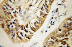 GDI2 Rabbit anti-Human, Mouse, Rat, Polyclonal, Proteintech:Antibodies:Primary