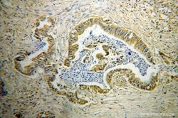 GDI2 Rabbit anti-Human, Mouse, Rat, Polyclonal, Proteintech:Antibodies:Primary