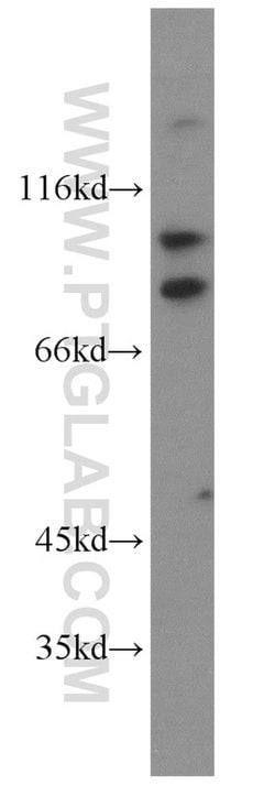 KIFC3 Rabbit anti-Human, Mouse, Rat, Polyclonal, Proteintech:Antibodies:Primary