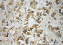 LRRC1 Rabbit anti-Human, Mouse, Rat, Polyclonal, Proteintech 150 &mu;L;