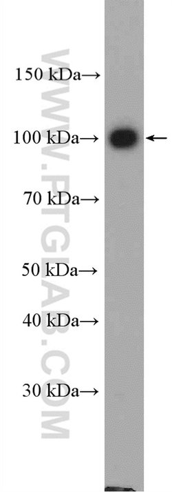 Adaptin Rabbit anti-Human, Polyclonal, Proteintech:Antibodies:Primary Antibodies