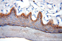 Cytokeratin 15 Rabbit anti-Human, Mouse, Rat, Polyclonal, Proteintech:Antibodies:Primary