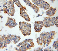 Cytokeratin 15 Rabbit anti-Human, Mouse, Rat, Polyclonal, Proteintech:Antibodies:Primary
