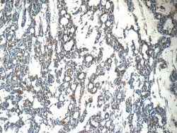 Cytokeratin 15 Rabbit anti-Human, Mouse, Rat, Polyclonal, Proteintech:Antibodies:Primary
