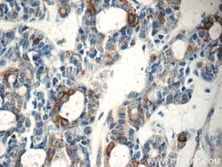 Cytokeratin 15 Rabbit anti-Human, Mouse, Rat, Polyclonal, Proteintech:Antibodies:Primary