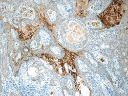 Cytokeratin 15 Rabbit anti-Human, Mouse, Rat, Polyclonal, Proteintech:Antibodies:Primary