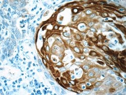 Cytokeratin 15 Rabbit anti-Human, Mouse, Rat, Polyclonal, Proteintech:Antibodies:Primary