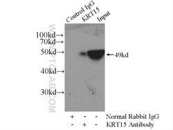 Cytokeratin 15 Rabbit anti-Human, Mouse, Rat, Polyclonal, Proteintech:Antibodies:Primary