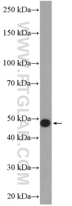 Cytokeratin 15 Rabbit anti-Human, Mouse, Rat, Polyclonal, Proteintech:Antibodies:Primary