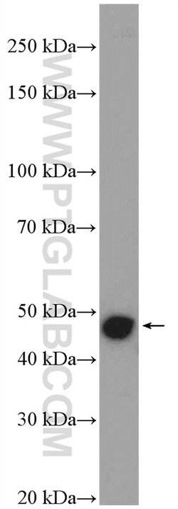 Cytokeratin 15 Rabbit anti-Human, Mouse, Rat, Polyclonal, Proteintech:Antibodies:Primary