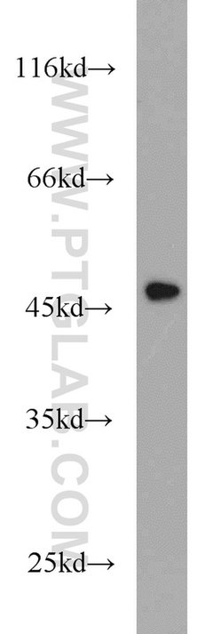 Cytokeratin 15 Rabbit anti-Human, Mouse, Rat, Polyclonal, Proteintech:Antibodies:Primary