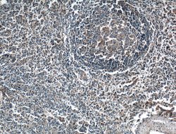 HVEM/TNFRSF14 Rabbit anti-Human, Polyclonal, Proteintech 150 &mu;L | Buy Online | Proteintech Group Inc | Fisher Scientific