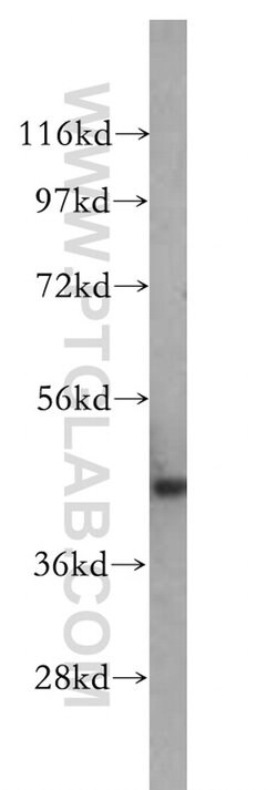 NSE Rabbit anti-Human, Mouse, Rat, Polyclonal, Proteintech:Antibodies:Primary
