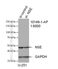 NSE Rabbit anti-Human, Mouse, Rat, Polyclonal, Proteintech:Antibodies:Primary