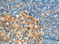 GNAS Rabbit anti-Human, Mouse, Polyclonal, Proteintech 150 &mu;L; Unconjugated:Antibodies,