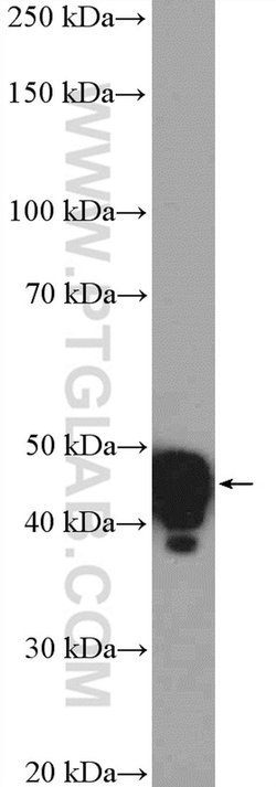 GNAS Rabbit anti-Human, Mouse, Polyclonal, Proteintech 150 &mu;L; Unconjugated:Antibodies,