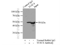 TUSC4 Rabbit anti-Human, Mouse, Rat, Polyclonal, Proteintech 20 &mu;L | Buy Online | Proteintech | Fisher Scientific