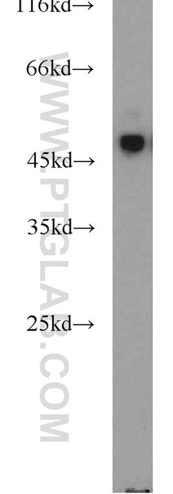 TUSC4 Rabbit anti-Human, Mouse, Rat, Polyclonal, Proteintech 20 &mu;L | Buy Online | Proteintech | Fisher Scientific