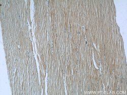 TUSC4 Rabbit anti-Human, Mouse, Rat, Polyclonal, Proteintech 20 &mu;L | Buy Online | Proteintech | Fisher Scientific