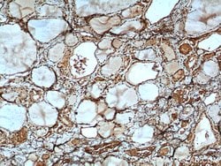 MYCN Rabbit anti-Human, Mouse, Rat, Polyclonal, Proteintech:Antibodies:Primary
