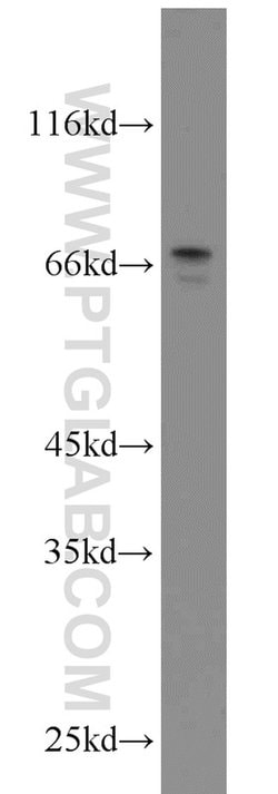 MYCN Rabbit anti-Human, Mouse, Rat, Polyclonal, Proteintech:Antibodies:Primary