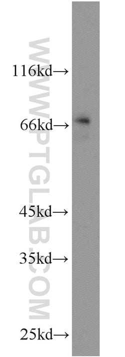 MYCN Rabbit anti-Human, Mouse, Rat, Polyclonal, Proteintech:Antibodies:Primary