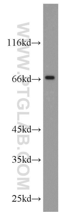 MYCN Rabbit anti-Human, Mouse, Rat, Polyclonal, Proteintech:Antibodies:Primary