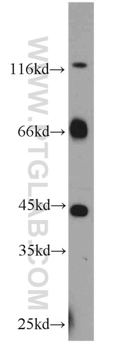 MYCN Rabbit anti-Human, Mouse, Rat, Polyclonal, Proteintech:Antibodies:Primary