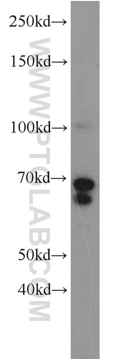 MYCN Rabbit anti-Human, Mouse, Rat, Polyclonal, Proteintech:Antibodies:Primary
