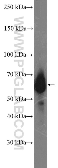 MYCN Rabbit anti-Human, Mouse, Rat, Polyclonal, Proteintech:Antibodies:Primary