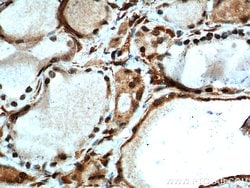 MYCN Rabbit anti-Human, Mouse, Rat, Polyclonal, Proteintech:Antibodies:Primary