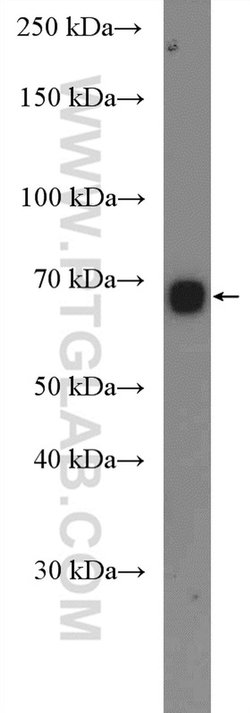 MYCN Rabbit anti-Human, Mouse, Rat, Polyclonal, Proteintech:Antibodies:Primary