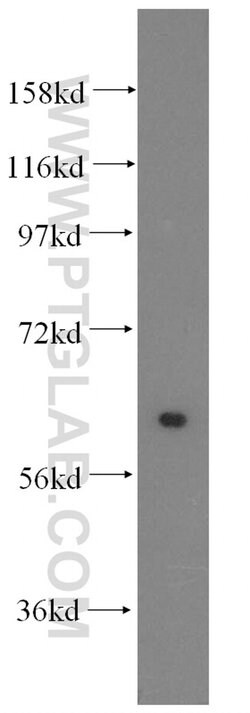 HSBP1 Rabbit anti-Human, Mouse, Rat, Polyclonal, Proteintech 150 &mu;L;