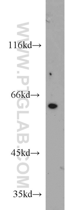 HSBP1 Rabbit anti-Human, Mouse, Rat, Polyclonal, Proteintech 150 &mu;L;