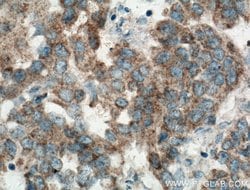 DCTN5 Rabbit anti-Human, Mouse, Rat, Polyclonal, Proteintech 20 &mu;L;