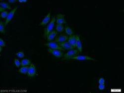 IGFBP3 Rabbit anti-Human, Mouse, Polyclonal, Proteintech:Antibodies:Primary
