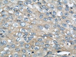IGFBP3 Rabbit anti-Human, Mouse, Polyclonal, Proteintech:Antibodies:Primary