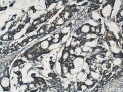 IGFBP3 Rabbit anti-Human, Mouse, Polyclonal, Proteintech:Antibodies:Primary