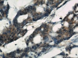 IGFBP3 Rabbit anti-Human, Mouse, Polyclonal, Proteintech:Antibodies:Primary