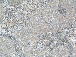IGFBP3 Rabbit anti-Human, Mouse, Polyclonal, Proteintech:Antibodies:Primary