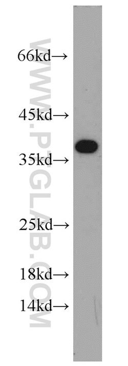 IGFBP3 Rabbit anti-Human, Mouse, Polyclonal, Proteintech:Antibodies:Primary