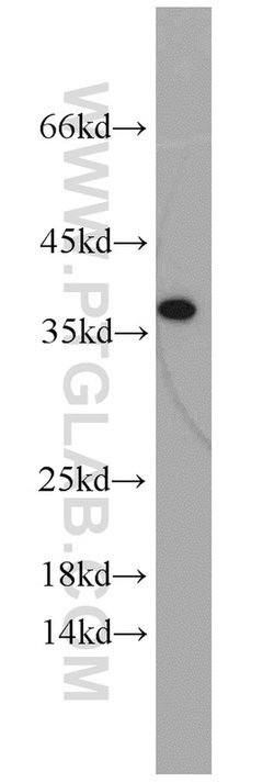 IGFBP3 Rabbit anti-Human, Mouse, Polyclonal, Proteintech:Antibodies:Primary