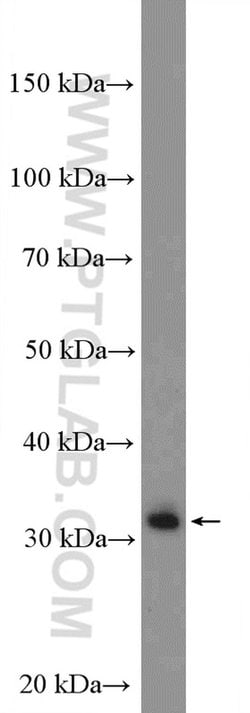 IGFBP3 Rabbit anti-Human, Mouse, Polyclonal, Proteintech:Antibodies:Primary