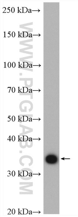 IGFBP3 Rabbit anti-Human, Mouse, Polyclonal, Proteintech:Antibodies:Primary